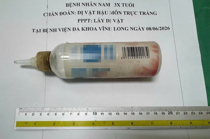 Chai nhựa sau khi được lấy ra khỏi trực tràng bệnh nhân. Ảnh: Bệnh viện cung cấp