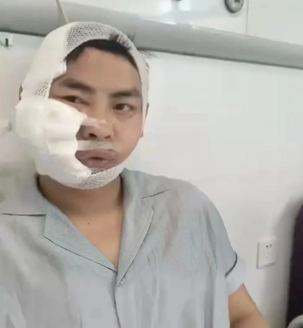 Khách Trung Quốc bất ngờ bị cá mập 3m tấn công khi lặn trong thủy cung - 1
