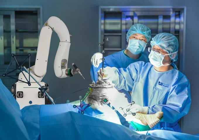 Bác sĩ thay khớp gối cho người bệnh bằng robot AI thế hệ mới Cuvis-Joint. Ảnh: Bệnh viện Đa khoa Tâm Anh
