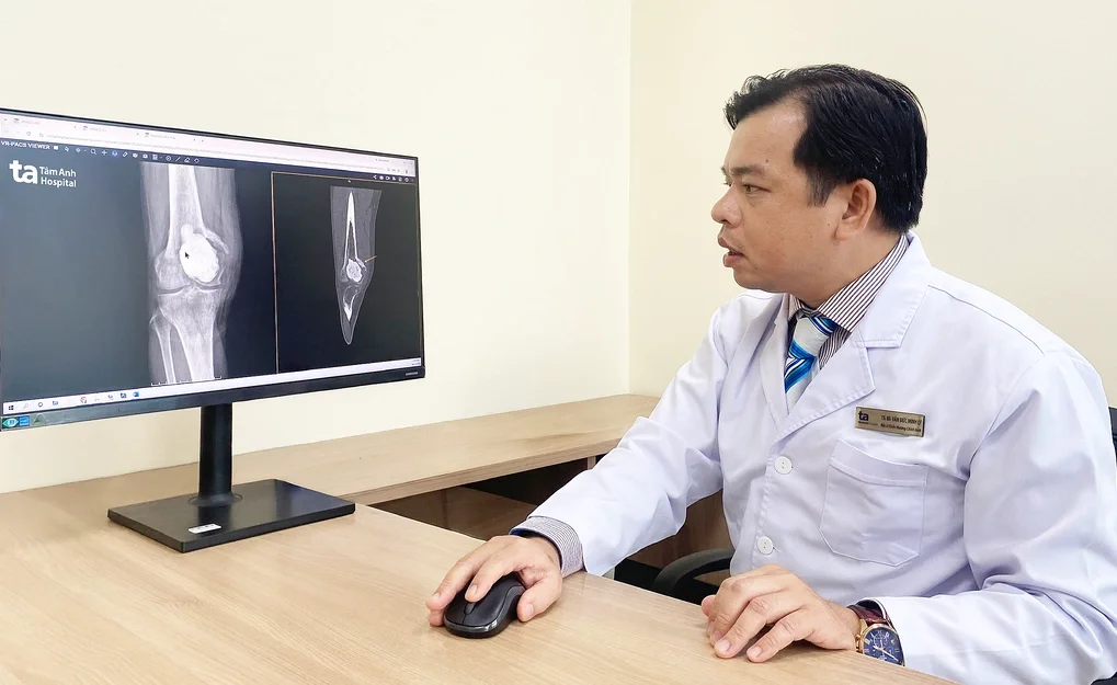 Bác sĩ Lý đánh giá vị trí khối u phá hủy phần lớn cấu trúc khớp gối của anh Thái. Ảnh: Bệnh viện Đa khoa Tâm Anh