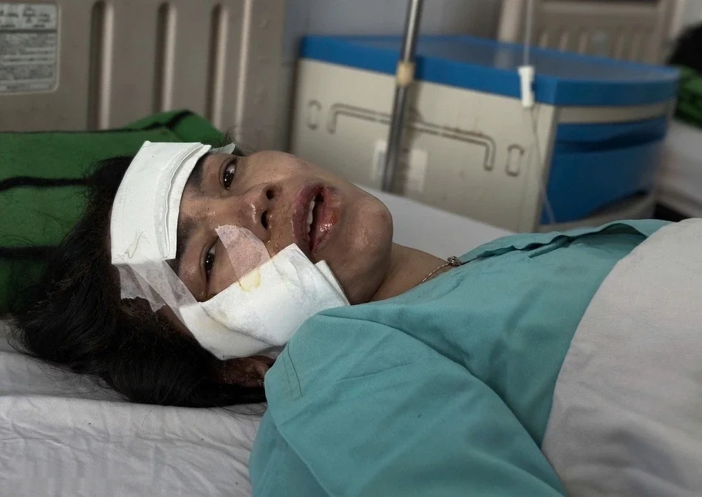 Chị Ngọc Bích kể lại khoảng khắc cùng chồng và hai con thoát khỏi xe khách cháy sau tại nạn ở xã Hưng Thịnh, Đồng Nai. Ảnh: Đình Văn