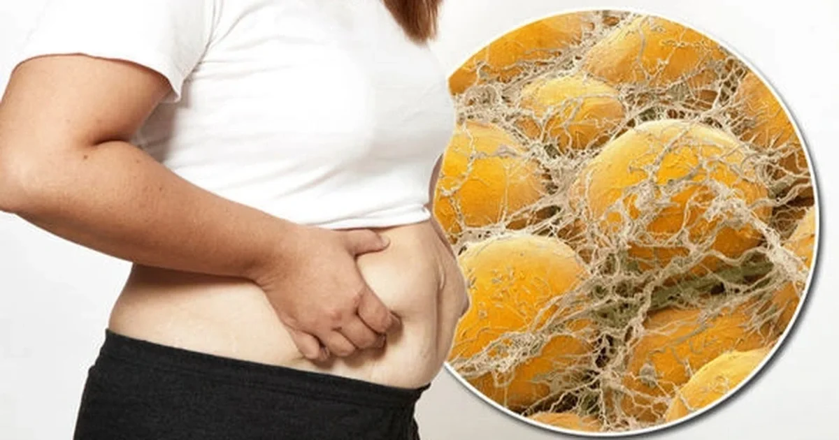 Vòng eo mãi không thon dù cố gắng giảm cân? Đây là 12 lỗi sai bạn có thể đang mắc phải